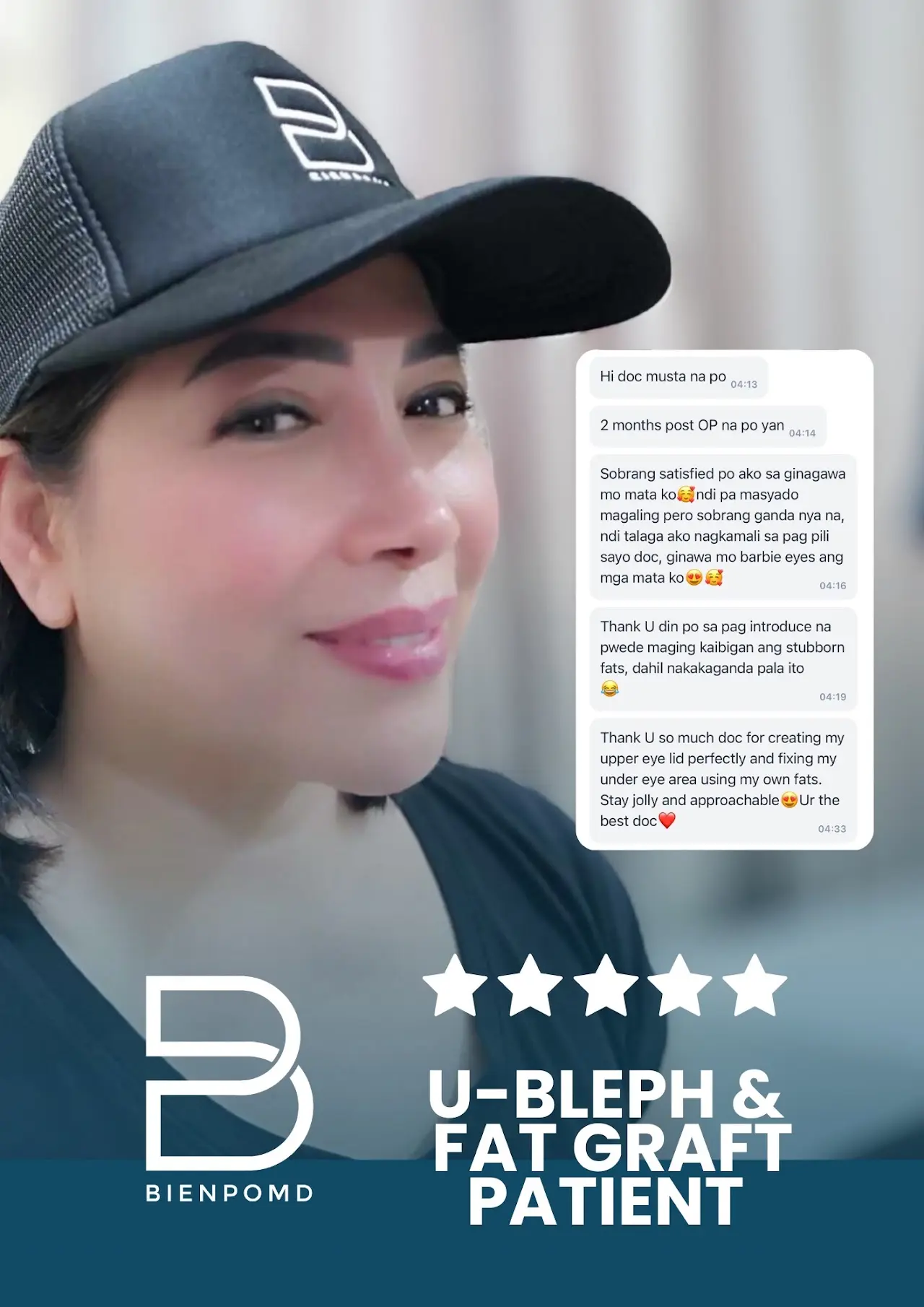 Upper Blepharoplasty patient review from the original BienPoMD website