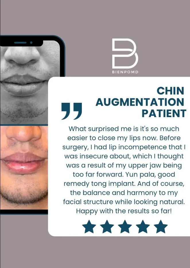 Chin Augmentation patient review about easier lip closure and improved facial balance