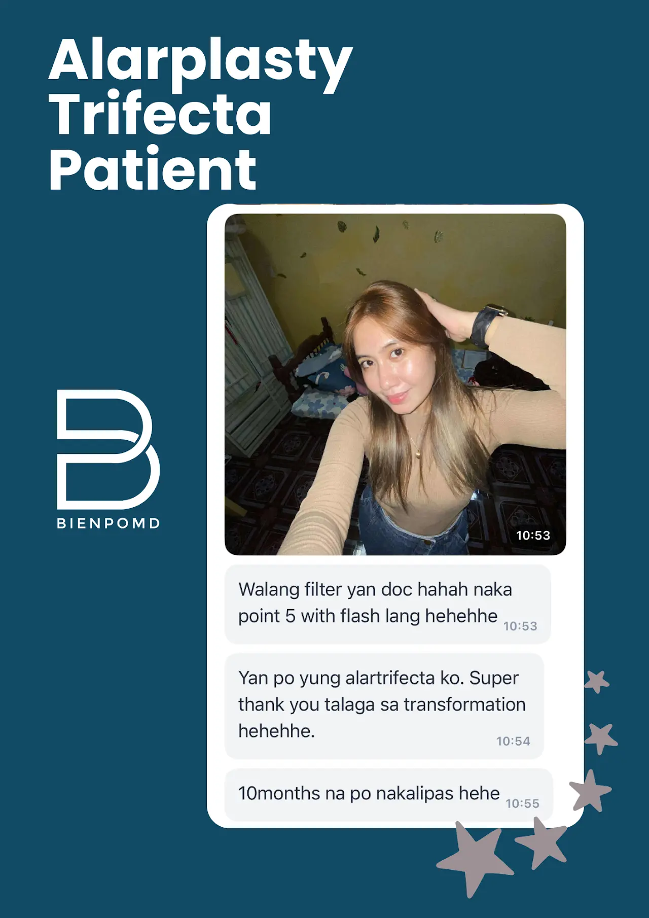 Alarplasty Trifecta patient review — no-filter look after surgery