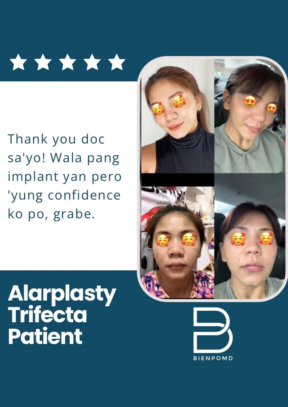 Alarplasty Trifecta patient review about improved confidence