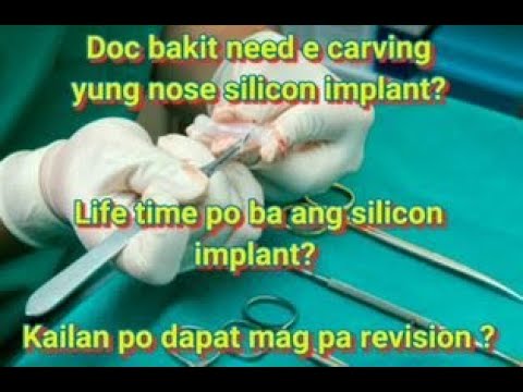 Silicone rhinoplasty video preview from 1palangganation