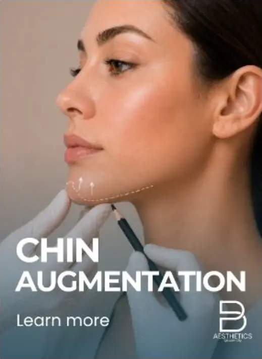 Chin Augmentation at BienPoMD Aesthetics