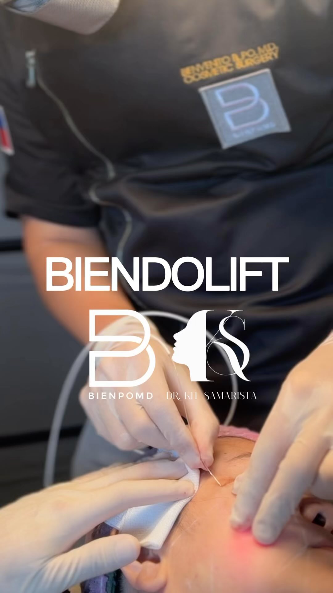 Biendolift Long-Term Rejuvenation video cover