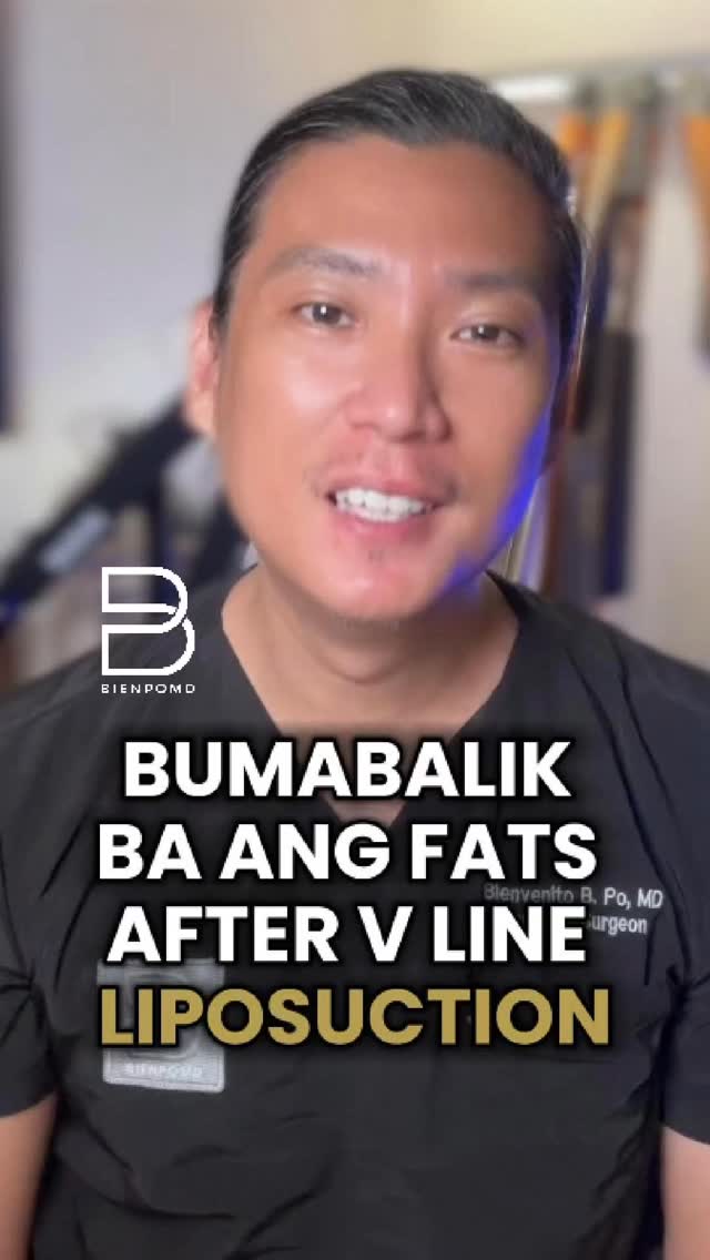 Do Fat Cells Return After V-line Lipo? thumbnail