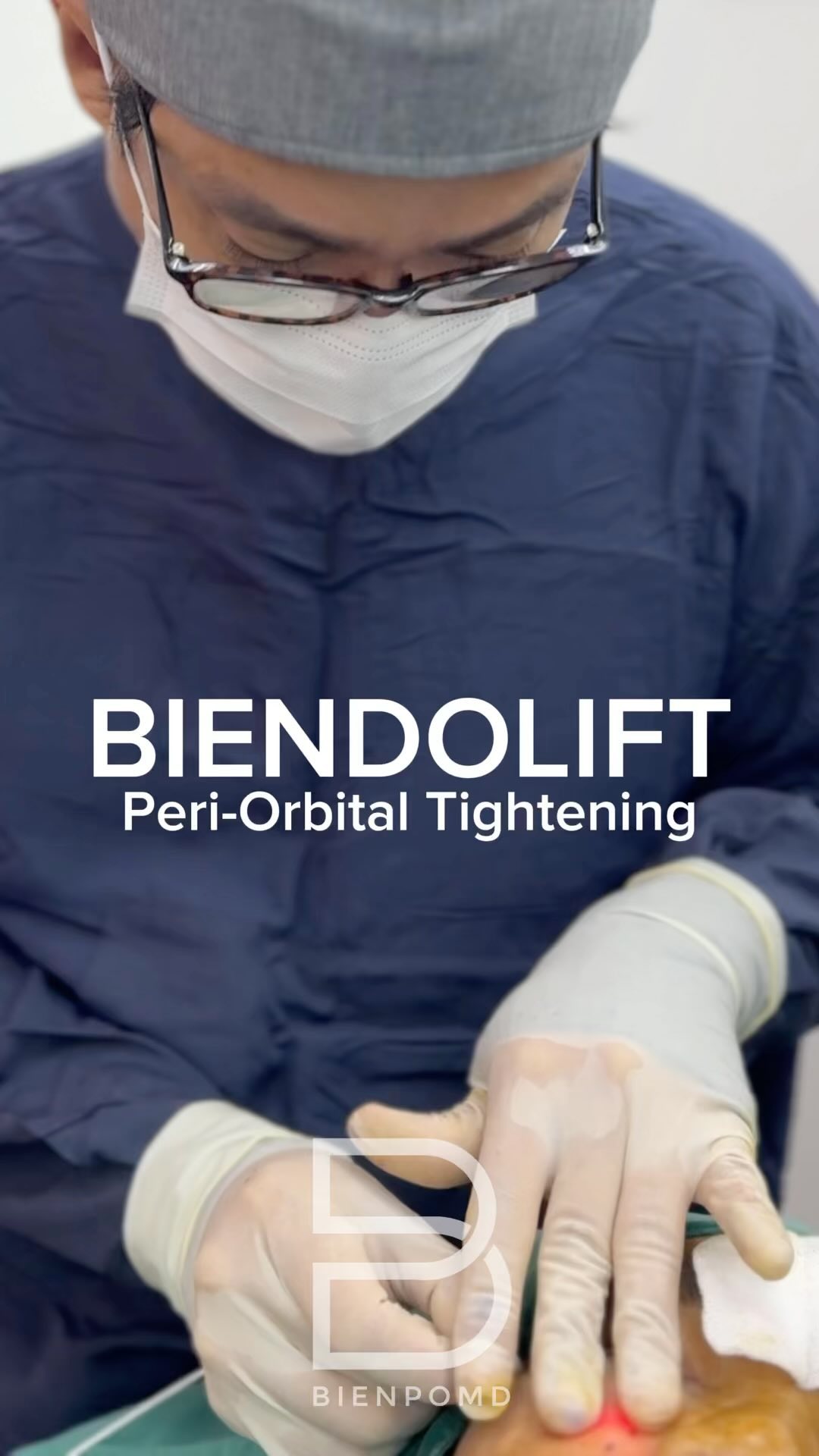 Biendolift Periorbital Tightening video cover