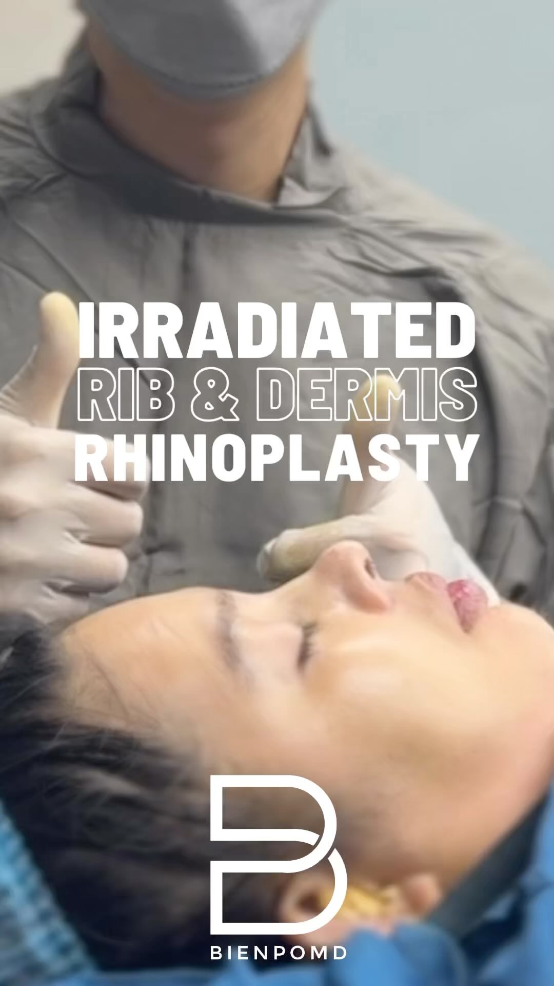 Facebook video about irradiated rib and acellular dermis, part 1 video cover