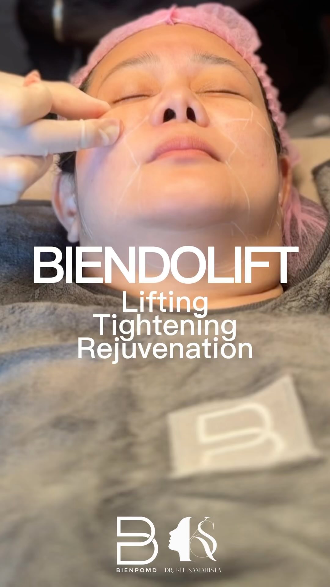 Biendolift: Lifting, Tightening, Rejuvenation video cover