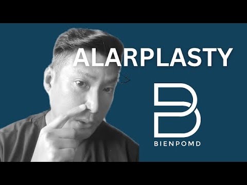 Alarplasty, Solusyon Para sa Sarat na Ilong official YouTube thumbnail
