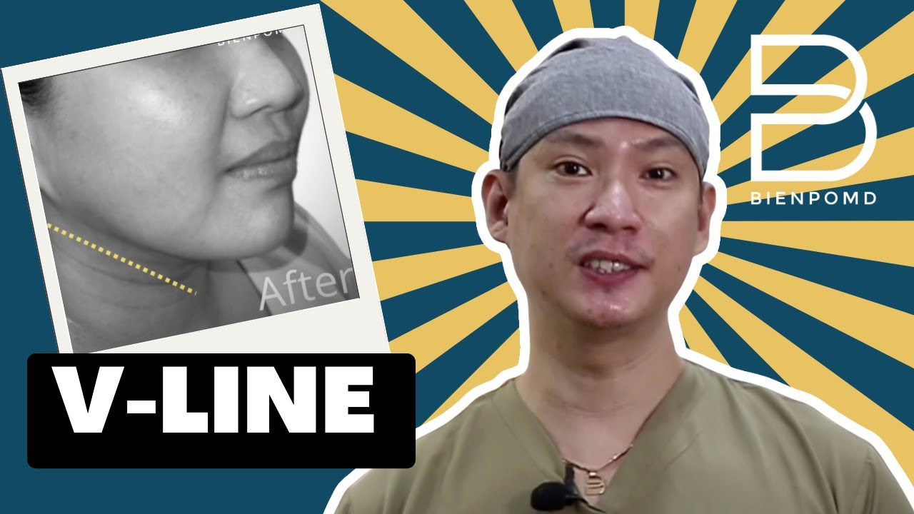 Achieving a Perfect V-Line: Liposuction and Contouring Techniques official YouTube thumbnail