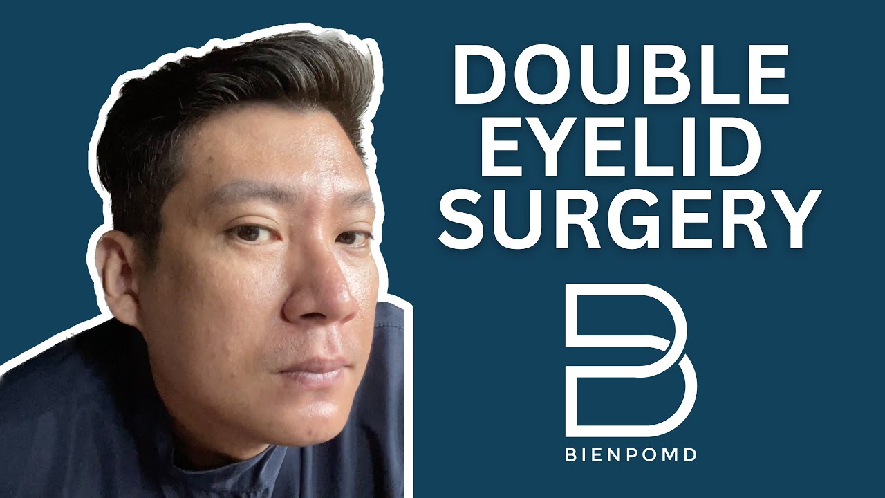 Pros and Cons ng Double Eyelid Surgery: Kailangan Mong Malaman official YouTube thumbnail